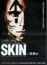画像: SKINスキン